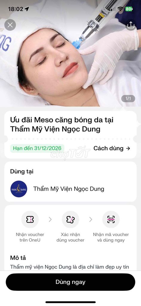 Dịch vụ làm đẹp Meso căng bóng da. Dịch vụ tại Quận 5 Tp Hồ Chí Minh được đăng bởi Thuý Vy hình 1