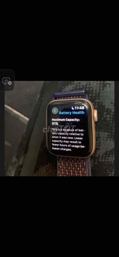 Apple Watch Series 6 Nữ. Mua bán Thiết bị đeo thông minh tại Quận Gò Vấp Tp Hồ Chí Minh được đăng bởi Lan Bulckaen -ai Medical hình 1