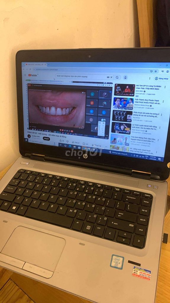 Laptop HP Core i5 Gen4 4GB/128GB. Mua bán Laptop tại Quận Bình Tân Tp Hồ Chí Minh được đăng bởi Mr Tung hình 1