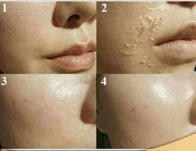 Muốn có làn da đẹp vê đội em ngay. Dịch vụ tại Thành phố Trà Vinh Trà Vinh được đăng bởi Bong