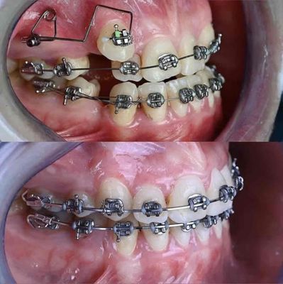 Nha Khoa Thành Phố Mới Bình Dương