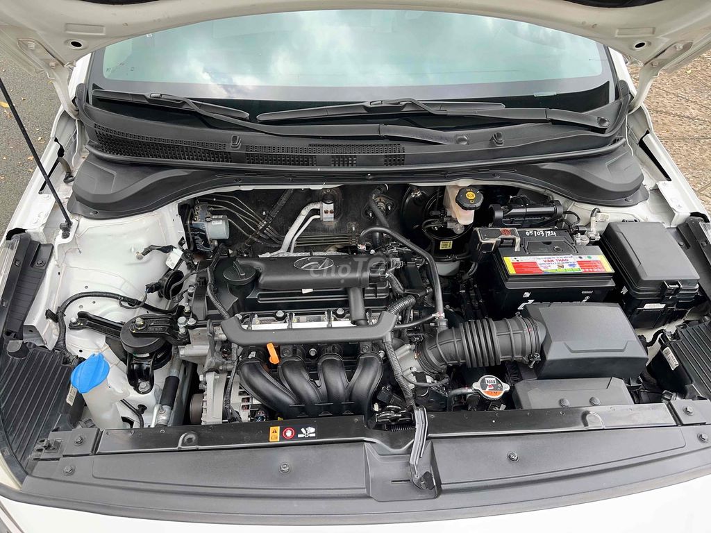 Hyundai Accent 2021 1.4 AT Đặc Biệt - 86000 km. Mua bán Ô tô tại Thành phố Bảo Lộc Lâm Đồng được đăng bởi Trần Hữu Trọng hình 10