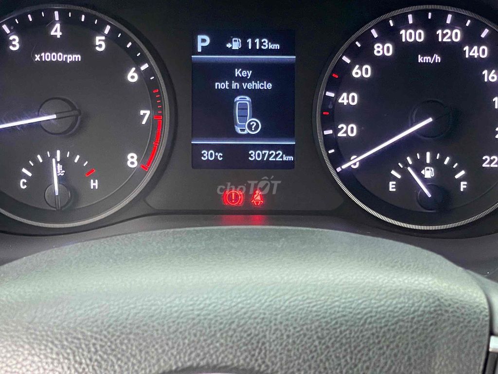 Hyundai Accent 2020 1.4AT - 30700 km giá 376 triêu. Mua bán Ô tô tại Quận 3 Tp Hồ Chí Minh được đăng bởi Ô TÔ SÀI GÒN hình 11