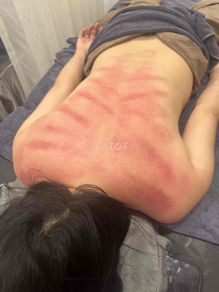 Cần tìm Kỹ Thuật Viên Spa