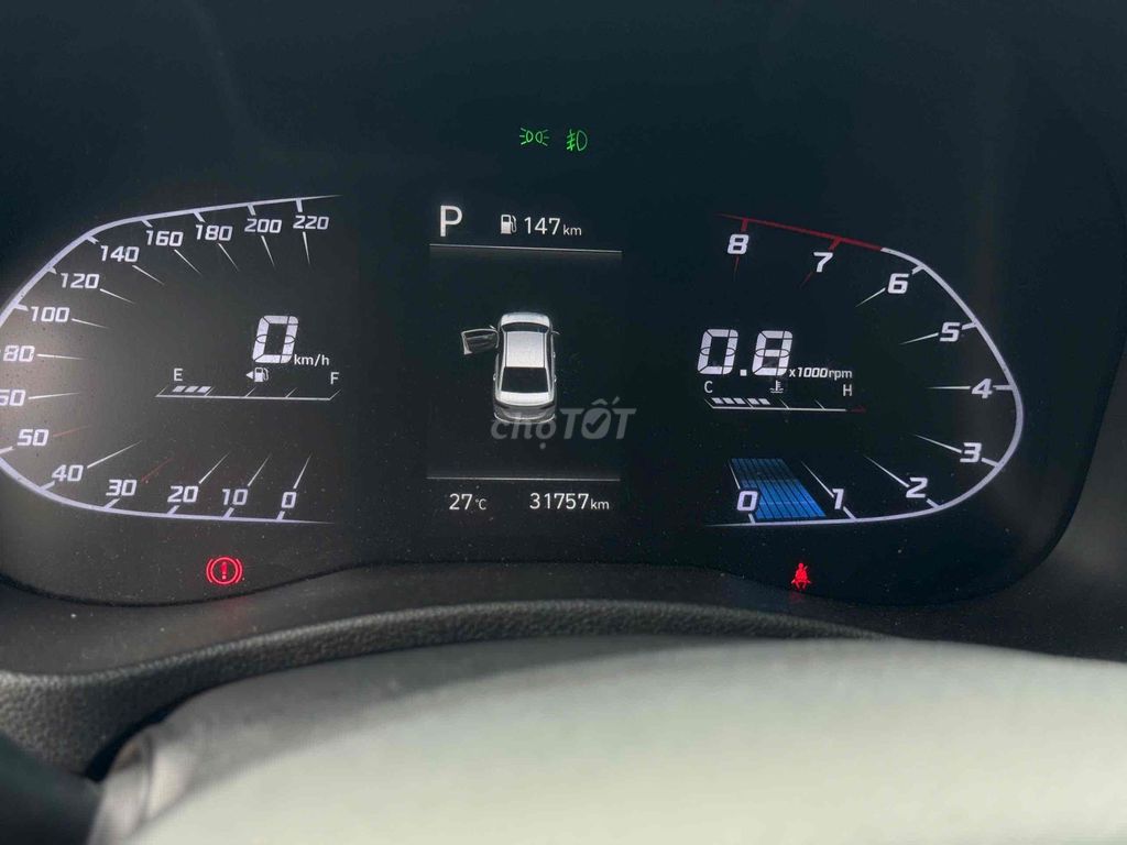 Accent AT Đặc Biệt 2023 Chỉ Từ 170Triệu. Mua bán Ô tô tại Quận Cái Răng Cần Thơ được đăng bởi Chuyên Mua Bán Ô Tô Qua Sử Dụng Carpla Cần Thơ hình 12