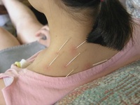 Trị liệu đau khớp tại quận 4