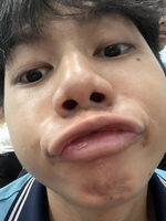 siêu nhân gao
