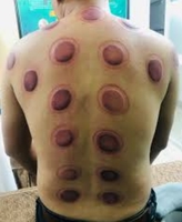 Nguyễn long