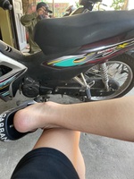 Chiến