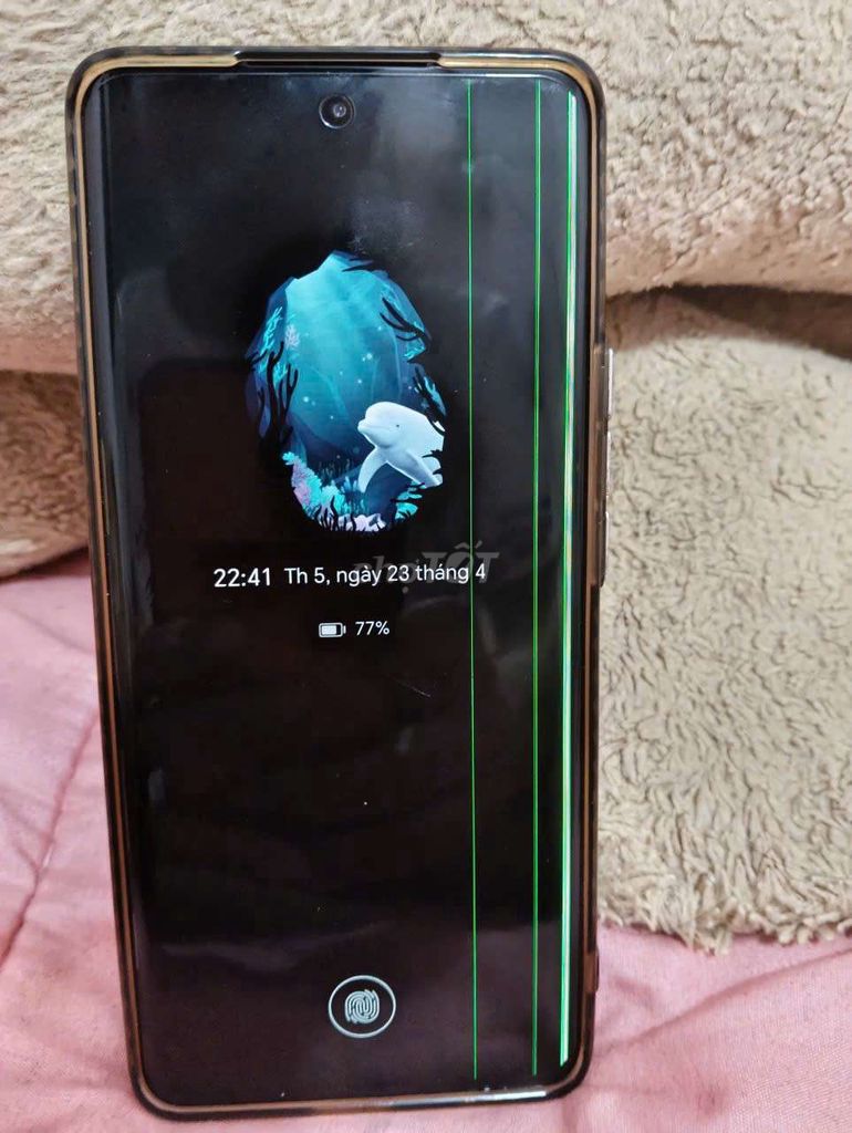 honor x9b5g. Mua bán Điện thoại tại Thành phố Vĩnh Long Vĩnh Long được đăng bởi Ty hình 1